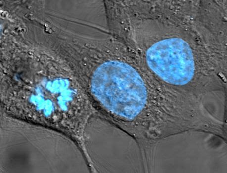 Immortalised cell line - Wikipedia