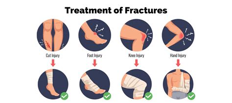 Greenstick Fracture | Complete Overview | Learn from doctor