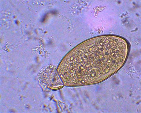 Fasciola hepatica emerging miracidium