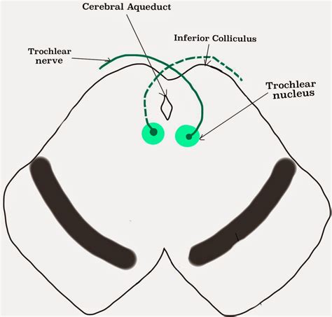 A Tale of Med Students: Trochlear Nerve – Cranial Nerve IV/4 (Easiest ...