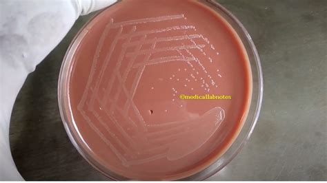 Haemophilus influenzae growth around bacitracin disk in chocolate agar ...