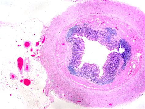 Vermiform Appendix Histology