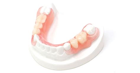 Lower Valplast Flexible partial | QualityDentalLab