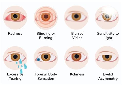 Dry Eye Disease - Walton Eye Care