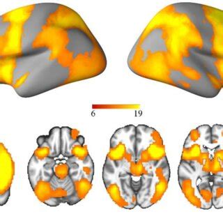 Brain activation maps for general response inhibition on whole ...