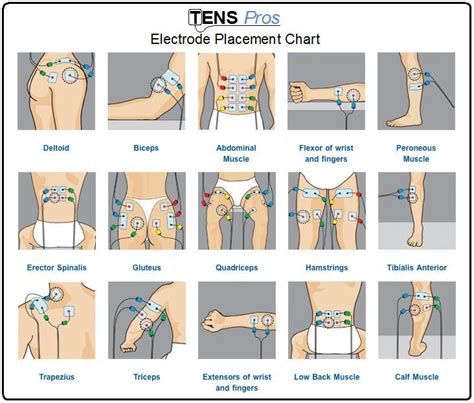 1000+ images about TENS Unit placement charts on Pinterest | The ...