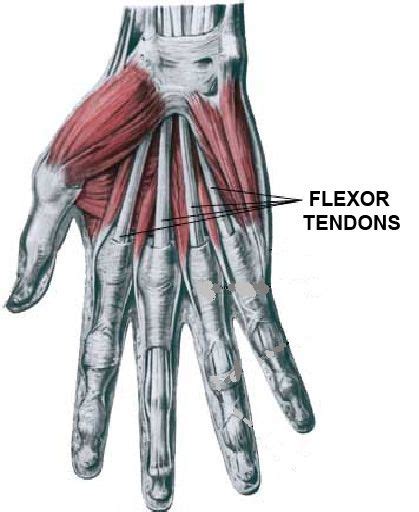 Hand Surgery Turkey - FLEXOR TENDON INJURIES