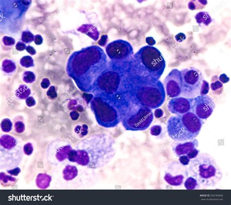 425 imágenes de Cancer biomarker - Imágenes, fotos y vectores de stock ...