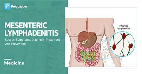 Mesenteric Lymphadenitis: Causes, Symptoms and Treatment