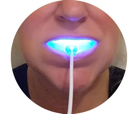 Teeth Whitening Light