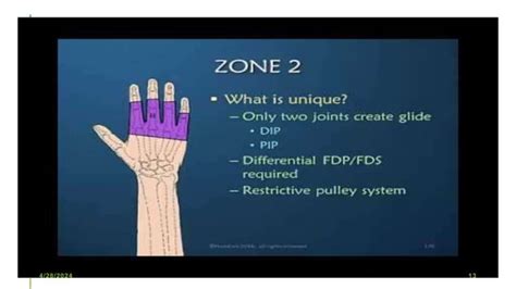 The flexor mechanism of the hand refers to the complex system of ...