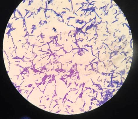 Gram Staining Under Microscope