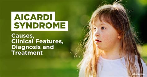 What Is Aicardi Syndrome?