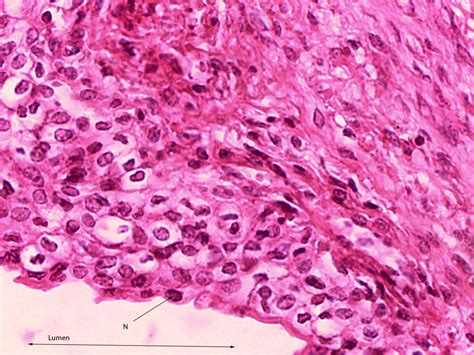 Transitional Epithelium 40X | Histology