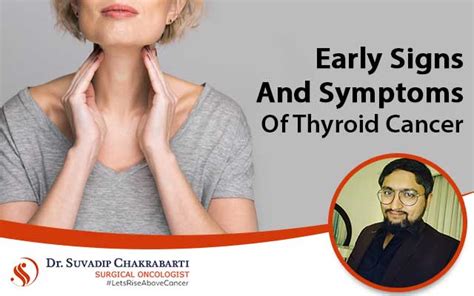 Early signs and symptoms of Thyroid Cancer