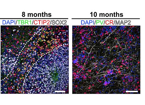 Brain Activity Detected in Mini Brains Grown From Stem Cells in Petri ...