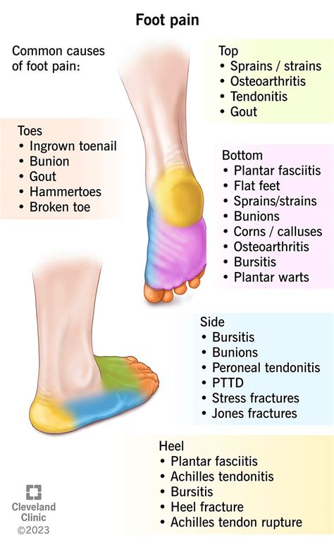 Foot Pain: Causes & Treatment