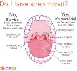 Facts About Strep Throat Symptoms | Go to FastMed for Strep Throat Symptoms