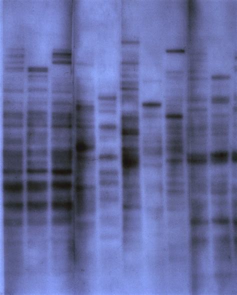 30th Anniversary Of DNA Fingerprinting - Science Museum Blog