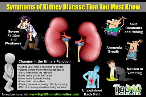 Top 10 Symptoms of Kidney Disease that You Need to Know | Top 10 Home ...