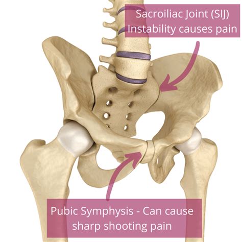 Symphysis pubis dysfunction (SPD) in pregnancy & Acupuncture