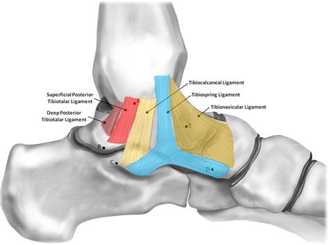 Subtalar Fusion? Do You Really Need This Surgery? - Regenexx