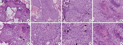 Variable histological features of adenomatoid odontogenic tumor. (A, E ...