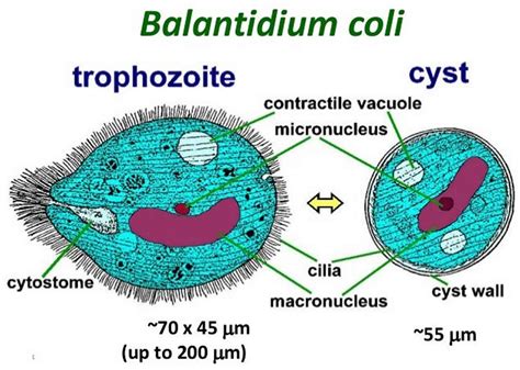 Balantidiasis causes, transimission, symptoms, diagnosis & treatment