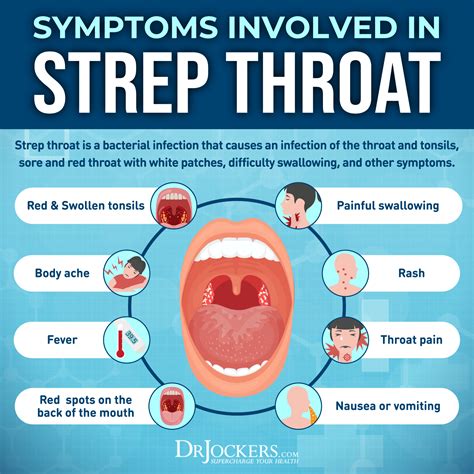 Strep throat antibiotics – Artofit