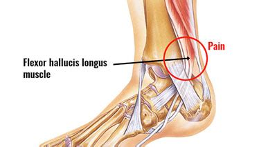 Inside Ankle Pain (Medial) - Symptoms, Causes, Treatment & Rehab