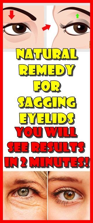 Natural Remedy For Sagging Eyelids You Will See Results In 2 Minutes ...