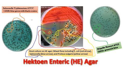 Hektoen Enteric Agar: Introduction, Principle, Composition, Preparation