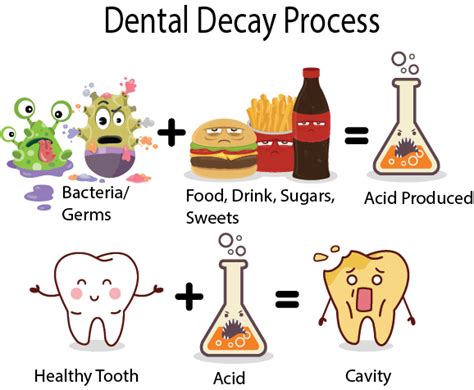 How To Prevent A Cavity - Documentride5