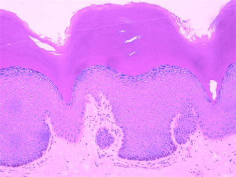 Stratified Squamous Keratinized Epithelium Labeled