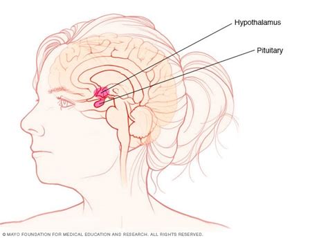 Prolactinoma - Symptoms and causes - Mayo Clinic