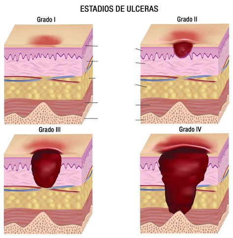 Material de enfermeria, Cuidados de enfermería, Cosas de enfermeria