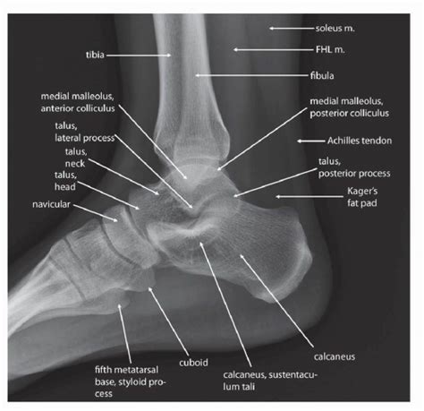 Foot Xray Anatomy - Anatomical Charts & Posters