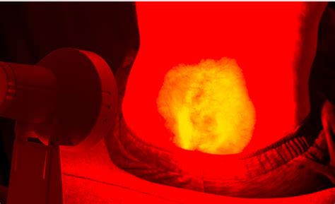 Infrared Radiation Therapy - Health Focus Physiotherapy