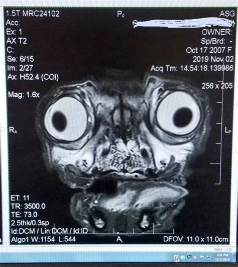 Someone Shows What A Pug’s MRI Scan Looks Like And It’s Pretty ...