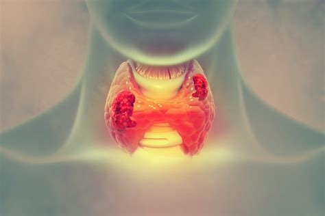 Toxic Nodular Goiter - Learn From An Endocrinologist : Dr. Zaidi