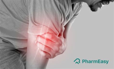 Myositis: Causes, Symptoms, Treatment And More! - PharmEasy Blog