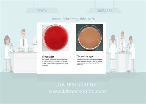 Chocolate Agar Media - Preparation and Uses | Lab Tests Guide