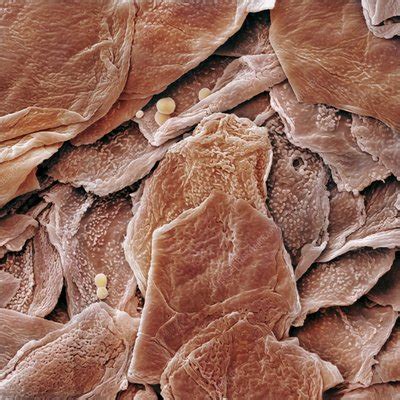 Human Skin Cells (SEM) - Stock Image - C015/0762 - Science Photo Library