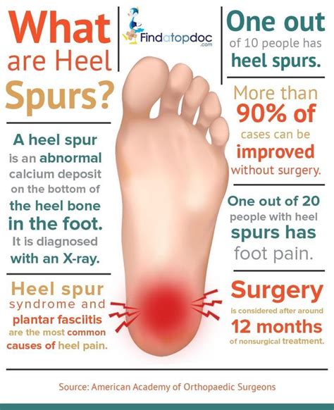 Heel Spurs: What are the Symptoms, Causes, and Treatments?