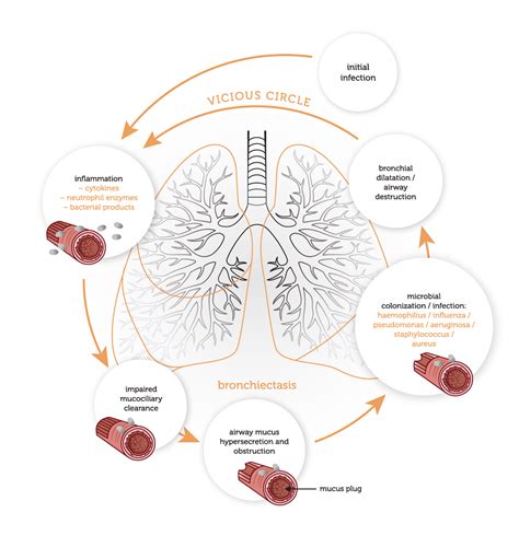 Pathophysiology - Bronchiectasis