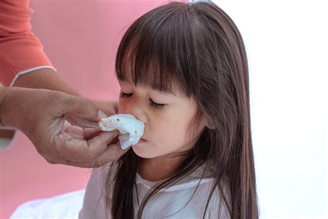 Nosebleeds in Children | Paediatric Medicine - Healthway Medical