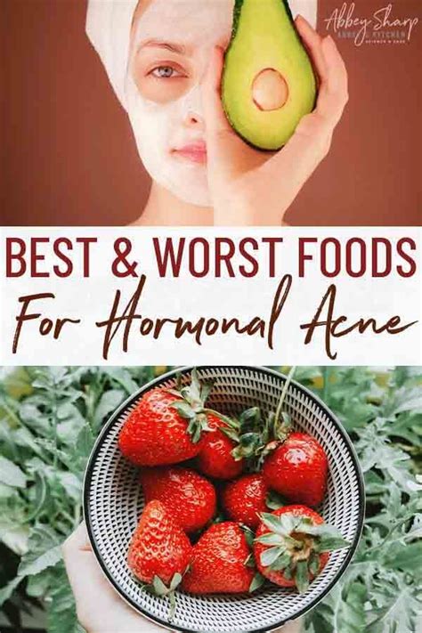 The Hormonal Acne Diet - The Best Foods for Healthy Clear Skin in 2021 ...