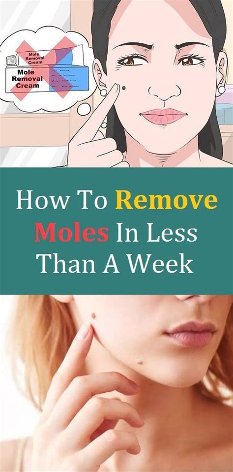 Diy Mole Removal - Tribuntech