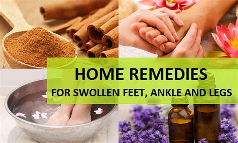 Home Remedies for Swollen Feet, Ankle and Legs