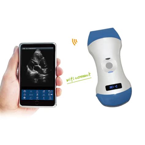 Portable Mini 5g Wireless Ultrasound Scan Probe &wifi Ultrasound ...